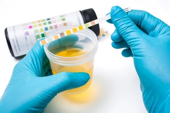 Urine Analyzer