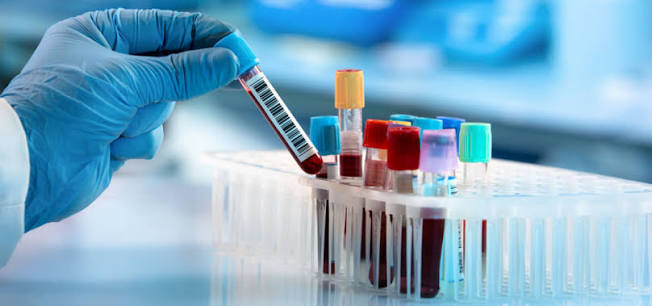 Immunoassay Analyzer